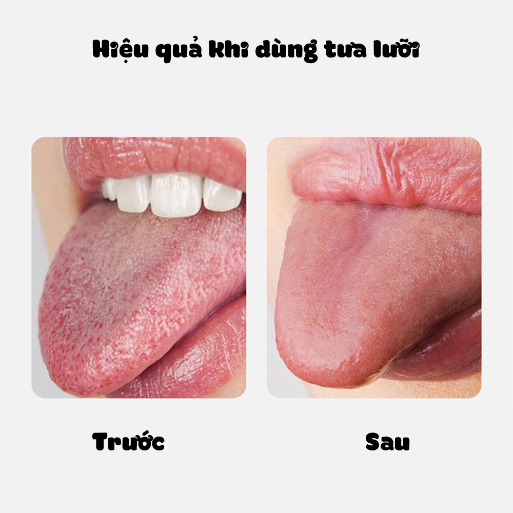 Dụng cụ cạo lưỡi, cây nạo lưỡi vệ sinh lưỡi người lớn bằng inox cao cấp