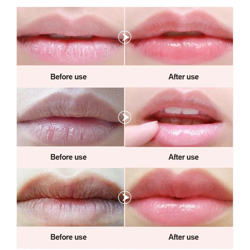 Son Dưỡng Môi Hanbi Vaseline Chiết Xuất Thực Vật Tự Nhiên Chống Nứt Nẻ Môi