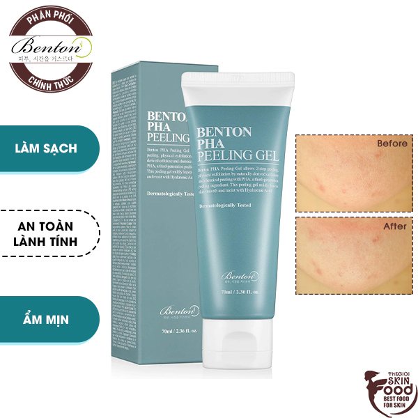 Tẩy Tế Bào Chết Dạng Gel Benton PHA Peeling Gel 70ml