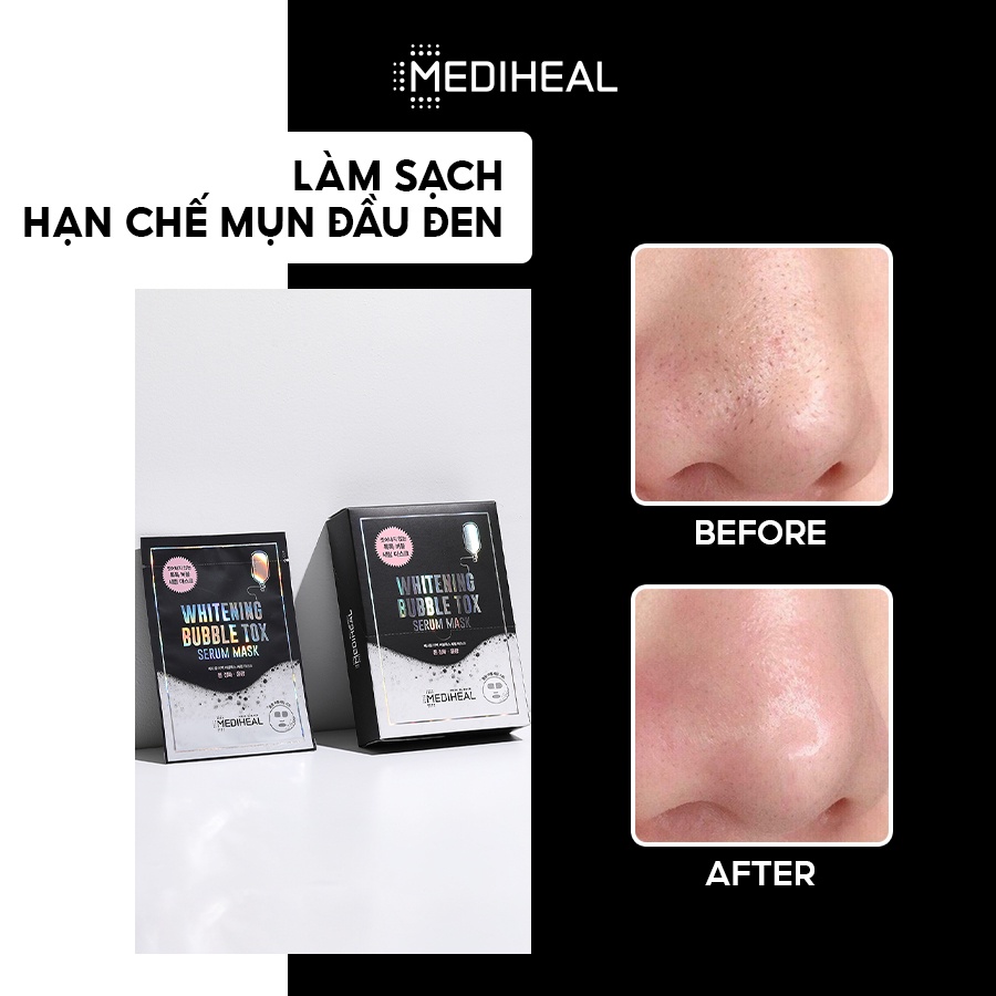 Mặt Nạ Thải Độc Mediheal Whitening Bubble Tox Serum Mask 25ml [K59]