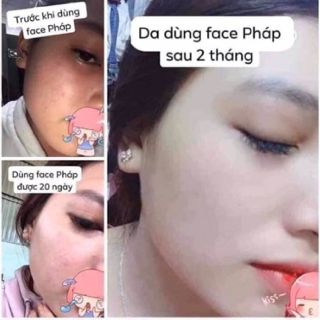KEM FACE PHÁP