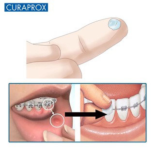 Bộ sản phẩm vệ sinh răng niềng curaprox ortho kit thụy sĩ - ảnh sản phẩm 6