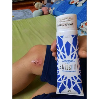 Gel bạc diệt khuẩn TRUSILVR
