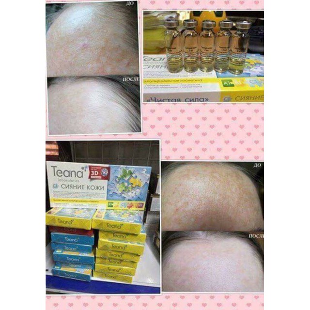 Collagen tươi Teana C1 Nga