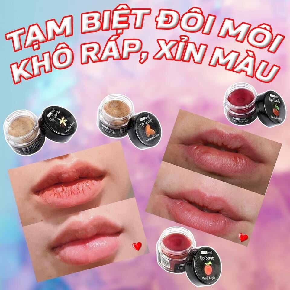 [Auth] Tẩy Da Chết Môi Beauty Treats Lip Scrub Mỹ