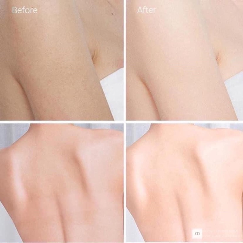 (có màu hồng và vàng) VASELINE 10X DÒNG SERUM GLUTA-HYA mới 2021 Nội địa Thái