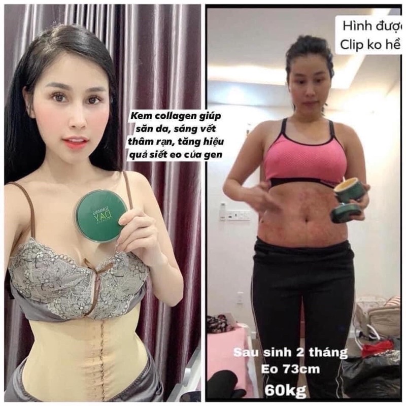 [ CHÍNH HÃNG ] KEM TAN MỠ MỜ THÂM RẠN SLIMMING DAY COLLAGEN