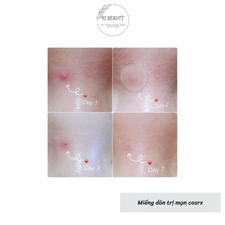 Dán mụn COSRX Acne Pimple Master Patch