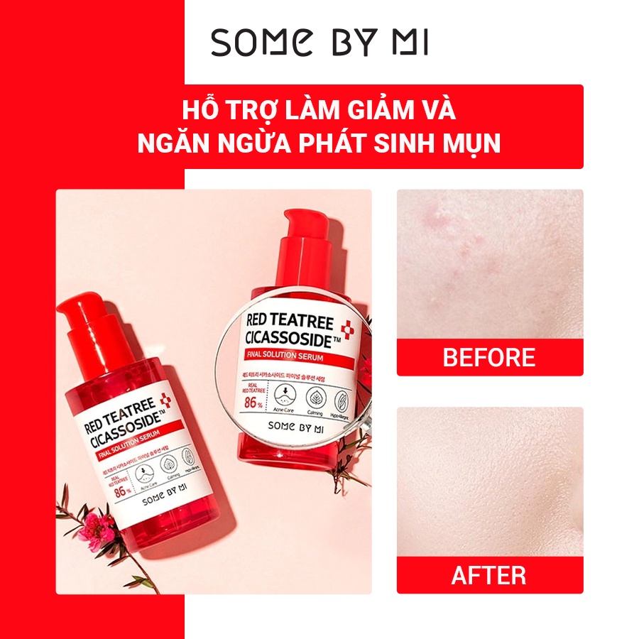 Tinh Chất Some By Mi Giảm Mụn Cho Da Nhạy Cảm Some By Mi Red Teatree Cicassoside Final 50ml