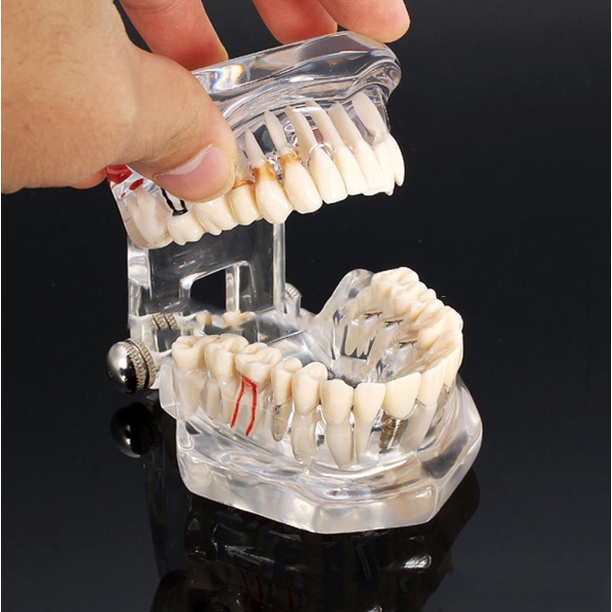 [Hàng mới về] Mô hình hàm răng đa năng chuyên dụng dành cho nha khoa