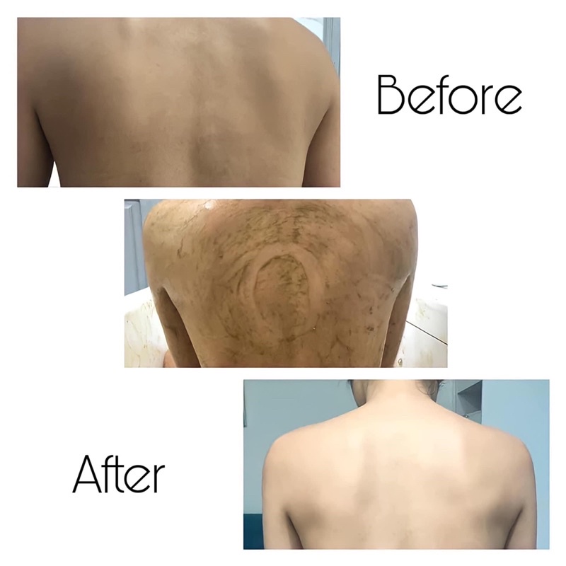 Thảo Mộc Tắm Trắng Nhau Thai Cừu - Thảo mộc dưỡng trắng body, trắng da, mềm mịn MEE NATURAL | BigBuy360 - bigbuy360.vn