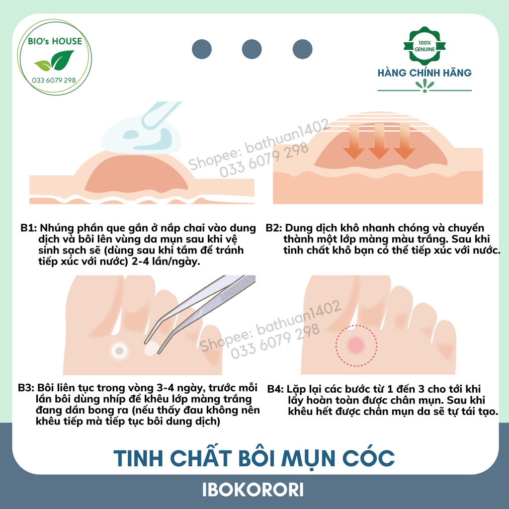 Tinh chất bôi mụn cóc IBOKORORI 10ml (Nhật Bản)