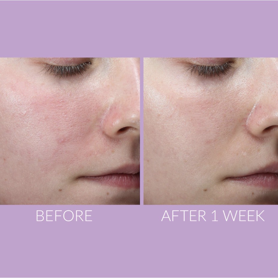 Serum dưỡng da Kate Somerville DeliKate Recovery - 10ml