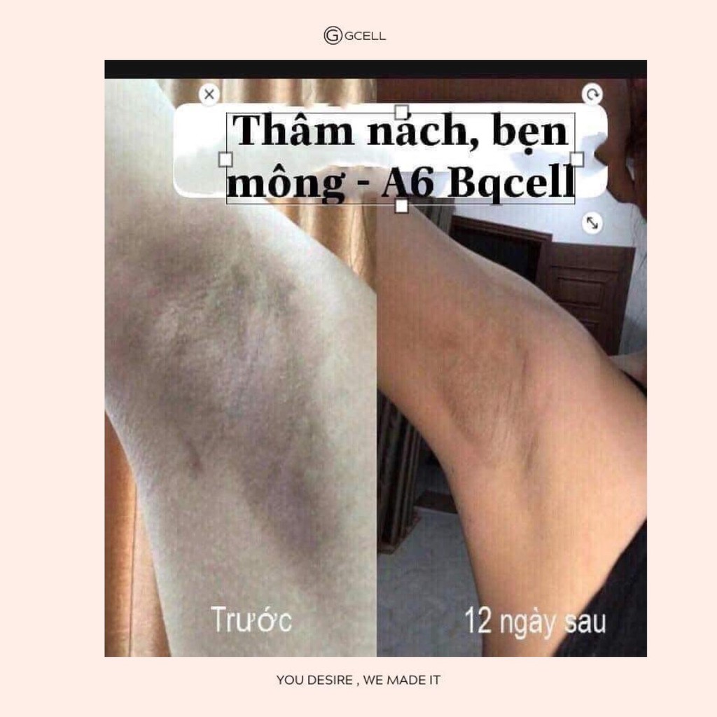 KEM LÀM TRẮNG NÁCH BẸN MÔNG GCELL XXVIRGIN A6