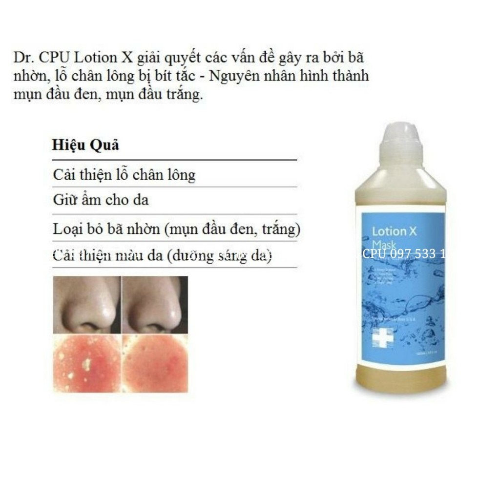 Lotion X Mask Dr CPU - Dung dịch ủ mụn làm sạch sợi bã nhờn, mụn cám, mụn đầu đen