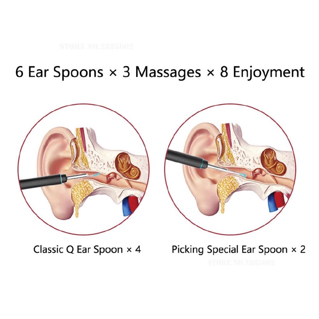 Dụng Cụ Lấy Ráy Tai Thông Minh Xiaomi Bebird M9 Pro - Hàng Chính Hãng