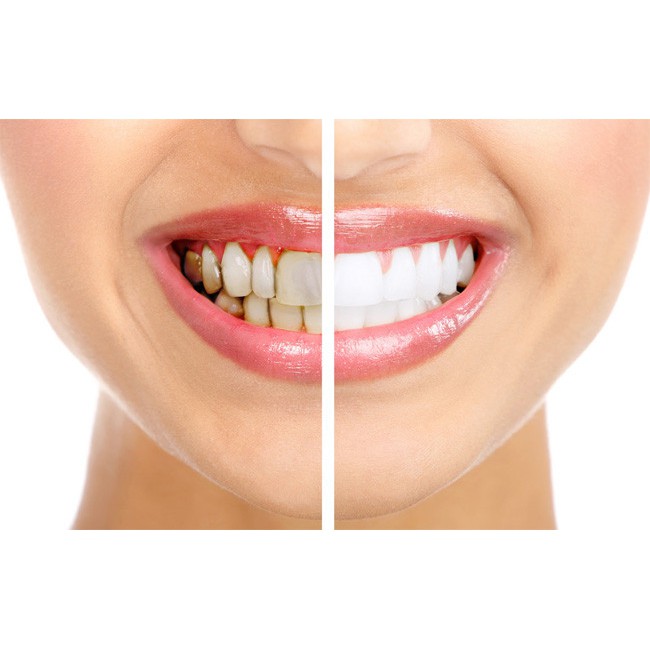 Combo 2 hộp bột làm trắng răng Eucryl - Nhập khẩu Anh - CC7282 - BX2018
