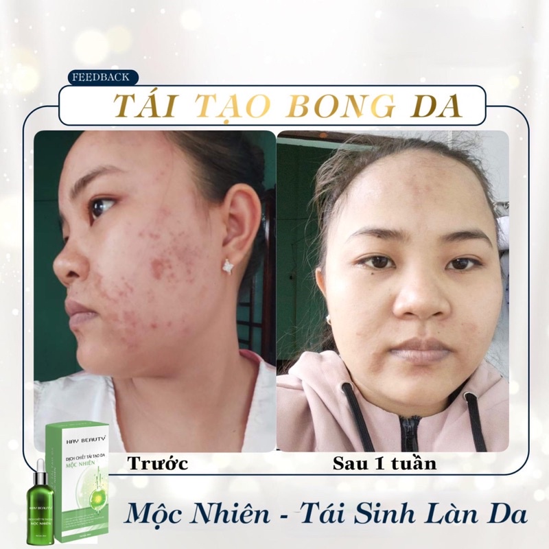 Tái tạo da mộc nhiên đông y ( mua 2 tăng bột rửa mặt giá 150k)