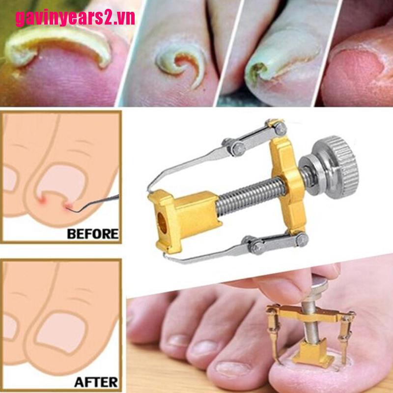 Bộ 2 Dụng Cụ Kích Thích Tăng Trưởng Lưng Tiện Lợi