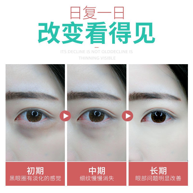 【Beautifulying】  Electric massage eye cream to remove wrinkles and bags under the eyes fat particles dark circles artifact | BigBuy360 - bigbuy360.vn