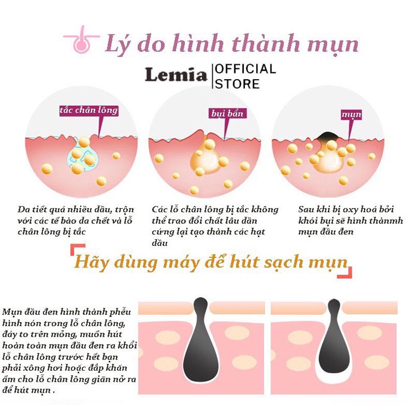 Máy hút mụn đầu đen có đầu làm nóng - dụng cụ làm sạch mụn Lemia mẫu mới 2022