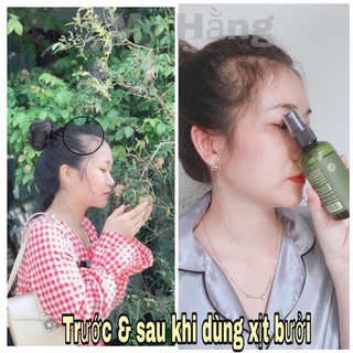 Xịt Bưởi Vi Jully Kích Mọc Tóc, Nhanh Dài Tóc