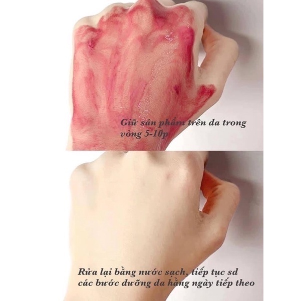 Serum tẩy tế bào chết hoá học The Ordinary AHA 30% + BHA 2% Peeling solution