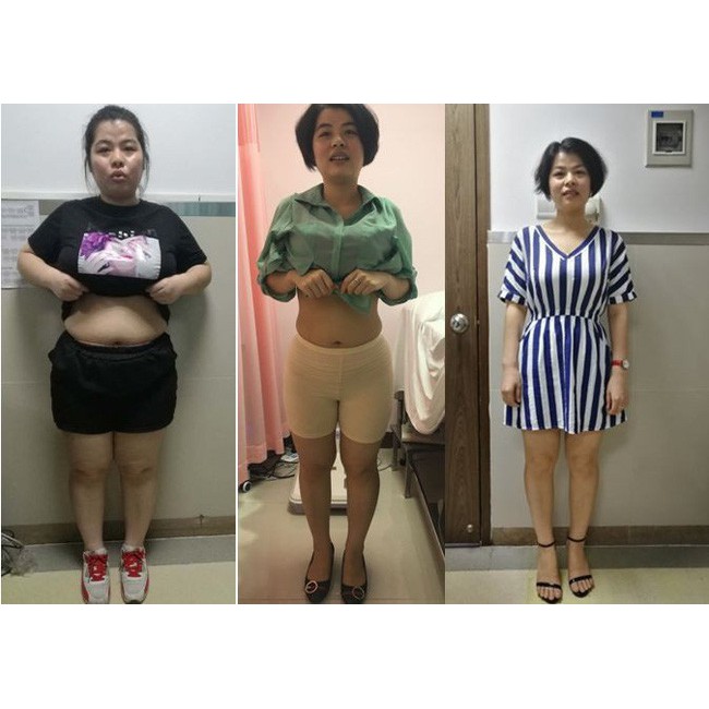 COMBO DELIM: 2 LỌ GIẢM CÂN  - HÀNG CHÍNH HÃNG | BigBuy360 - bigbuy360.vn