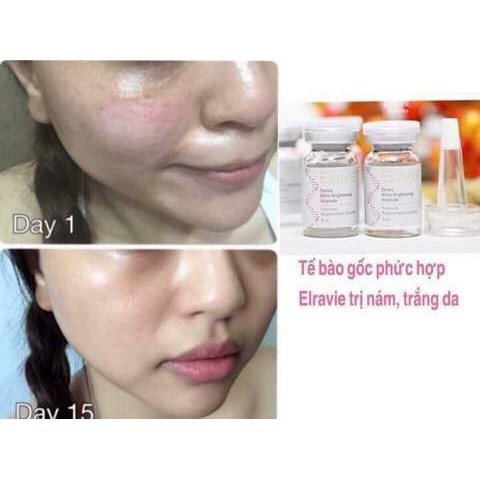 TẾ BÀO GỐC PHỨC HỢP ELRAVIE DERMA AMPOULE NHẬP KHẨU CHÍNH HÃNG