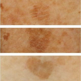 (Bill Đức) Tinh chất nám Eucerin Đức