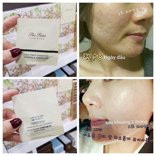 Combo 20 gói Tinh Chất Vàng Ohui The First Ampoule Advanced
