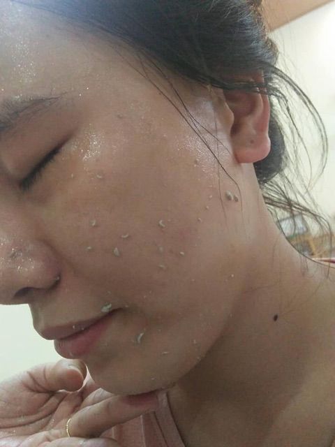 TẨY TẾ BÀO DA CHẾT