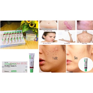 Kem sẹo Gentacin Nhật Bản 10gr - Hàng canh sales