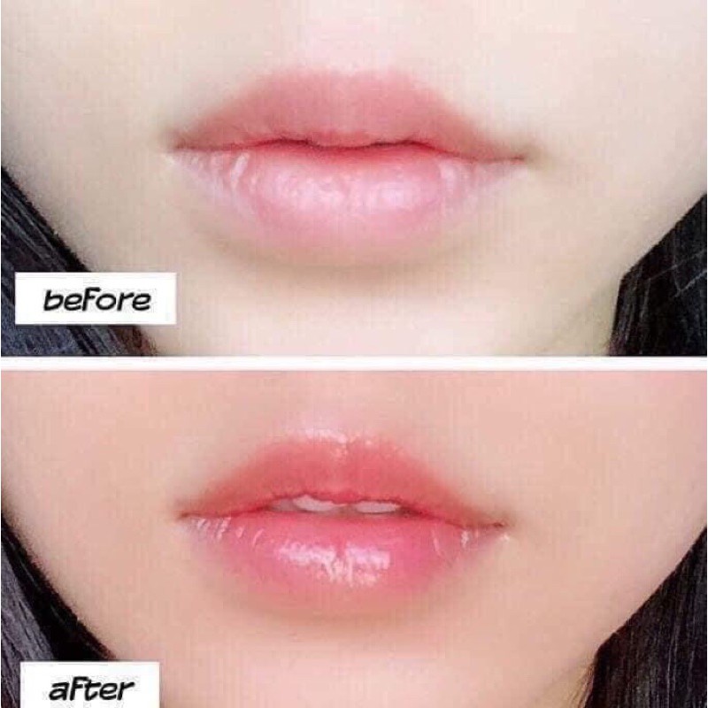 Son dưỡng môi Carmex | BigBuy360 - bigbuy360.vn