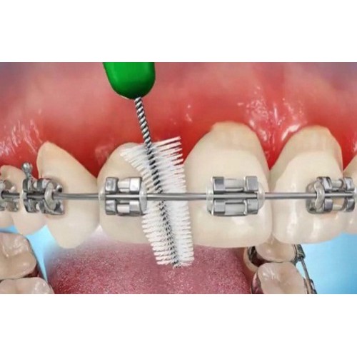 Bàn Chải Kẽ Răng Chuyên Dùng Cho Người Chỉnh Nha Nhật Bản [dạng chữ L - I]