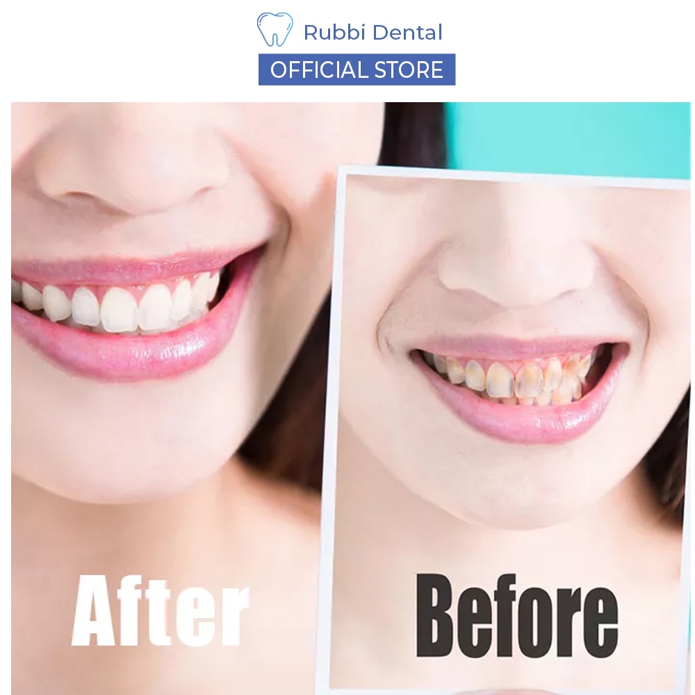 Miếng dán trắng răng SMILEKIT hương bạc hà bật tông cực nhanh