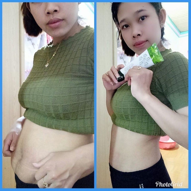 [chính hãng] Gel tan mỡ Lipo slim trong vòng 7 ngày giảm 3-5cm