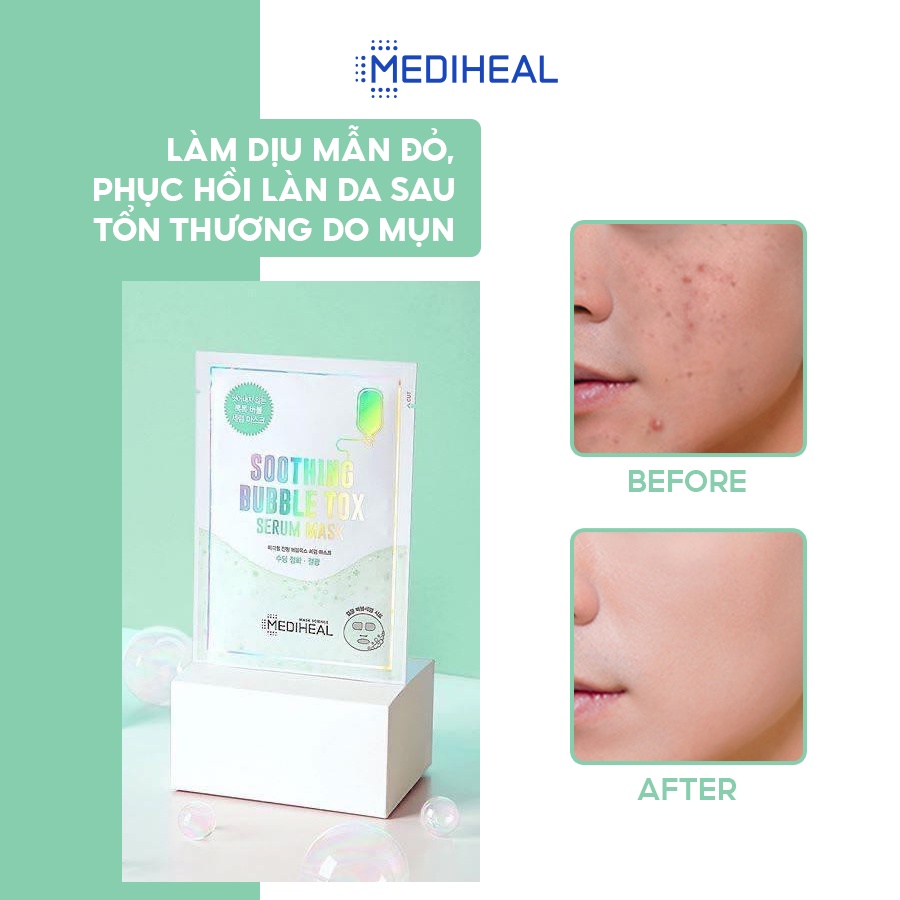 Mặt Nạ Sủi Bọt Thải Độc, Cấp Ẩm, Làm Dịu Da Mediheal Soothing Bubble Tox Serum Mask 25ml [K58]