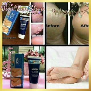 Kem trị nứt nẻ gót chân Kpem