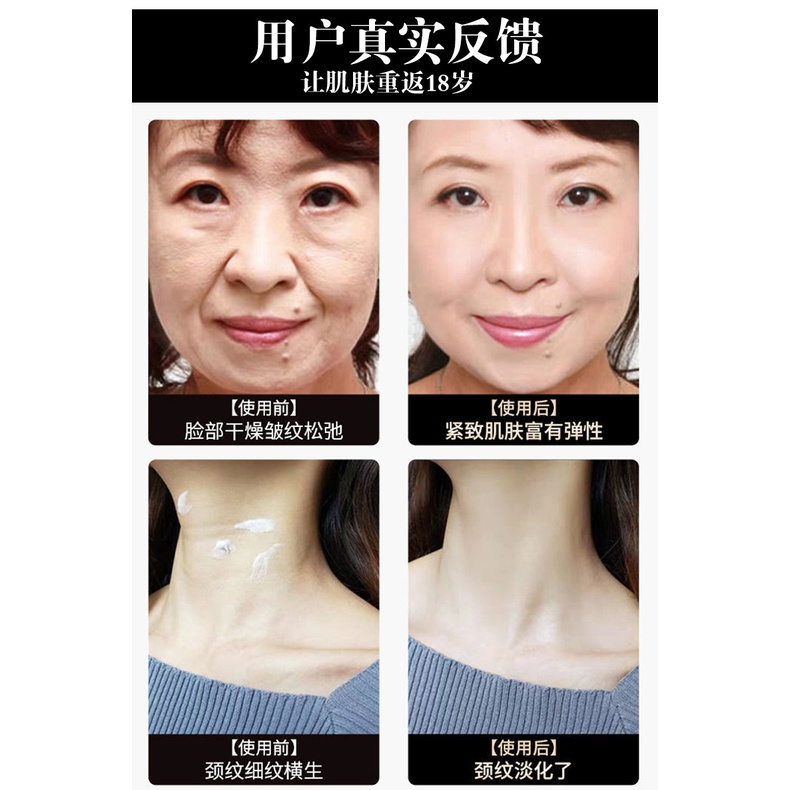 Kem polypeptide Yanjiayi 50g Dưỡng Ẩm Làm Săn Chắc Da Chống Nếp Nhăn Làm Trắng Da