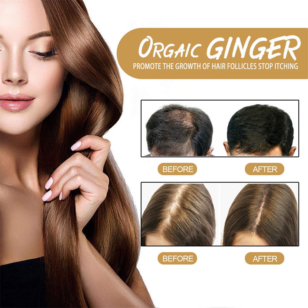 Eelhoe Xà Phòng Dầu Gội Gừng Xà Phòng Dầu Gội Tóc Đen Tóc Loại Bỏ Ve, Kiểm Soát Gàu, Kiểm Soát Dầu, Chống Rụng Và Ngứa-Ampere