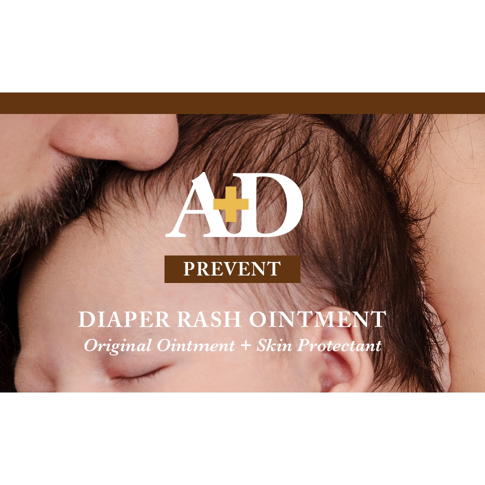 |Mẫu mới| A+D Original Diaper Rash Ointment Kem chống hăm với thành phần Lanolin and Petrolatum 454g