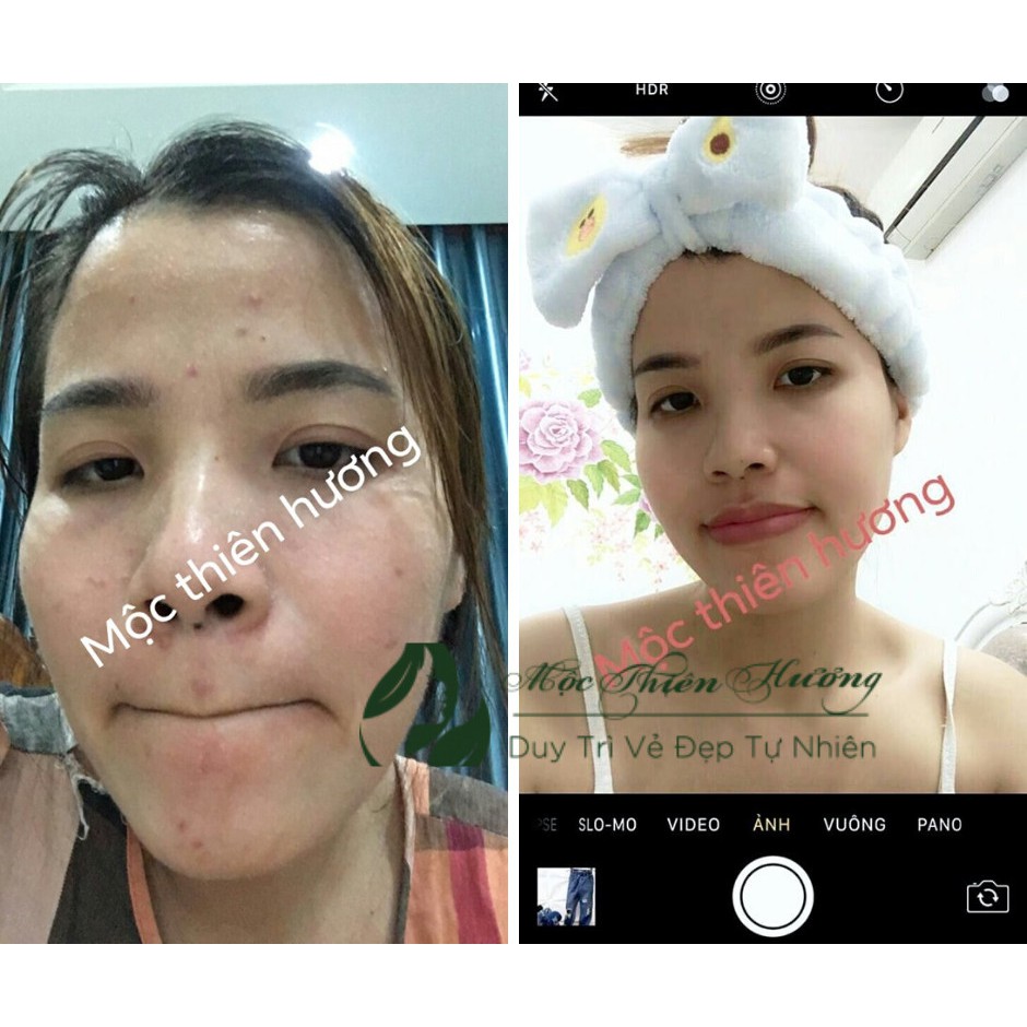 Serum giảm mụn thâm rỗ, sáng da, se khít lỗ chân lông Mộc Thiên Hương | BigBuy360 - bigbuy360.vn