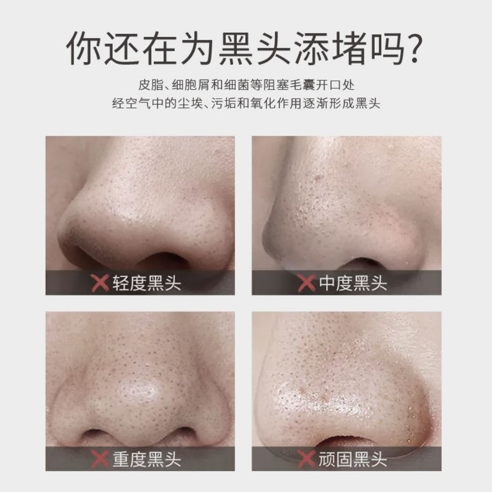 Miếng dán mũi lột mụn đầu đen cho nam nữ | BigBuy360 - bigbuy360.vn