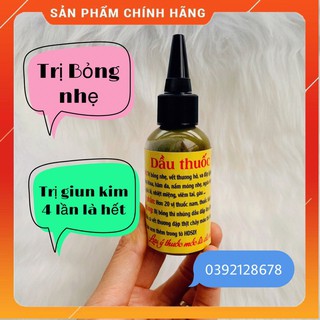 Dầu Minh Ngọc Bỏng Nhẹ Giun Kim 4 Lần Hết