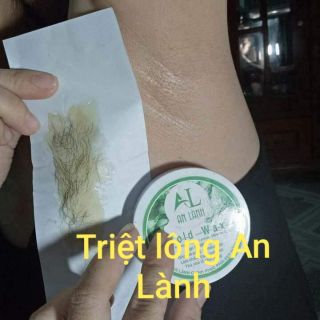 TRIỆT LÔNG NÁCH AN LÀNH
