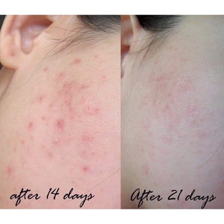 Serum vitamin C balance