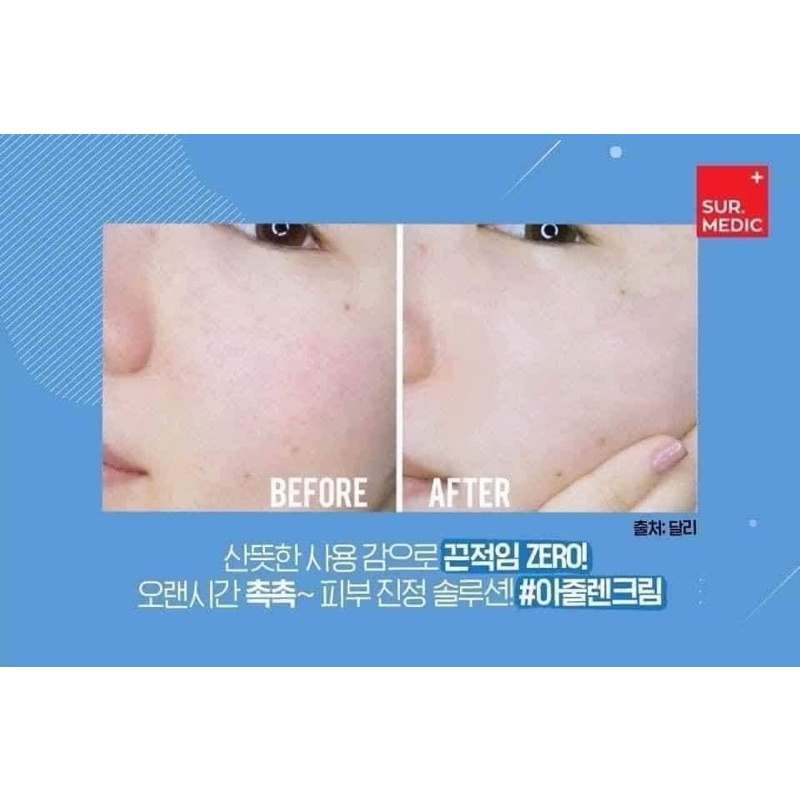 Mặt nạ dưỡng trắng Sur.Medic Bright Glutathione Mask Hàn Quốc