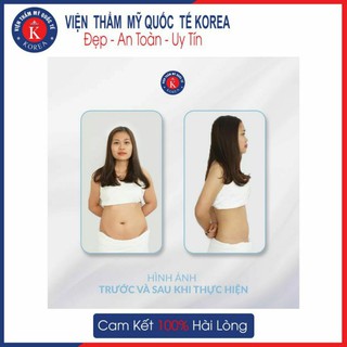 HN[VOUCHER] - GIẢM MỠ TOÀN THÂN tại VIỆN THẨM MỸ QUỐC TẾ KOREA
