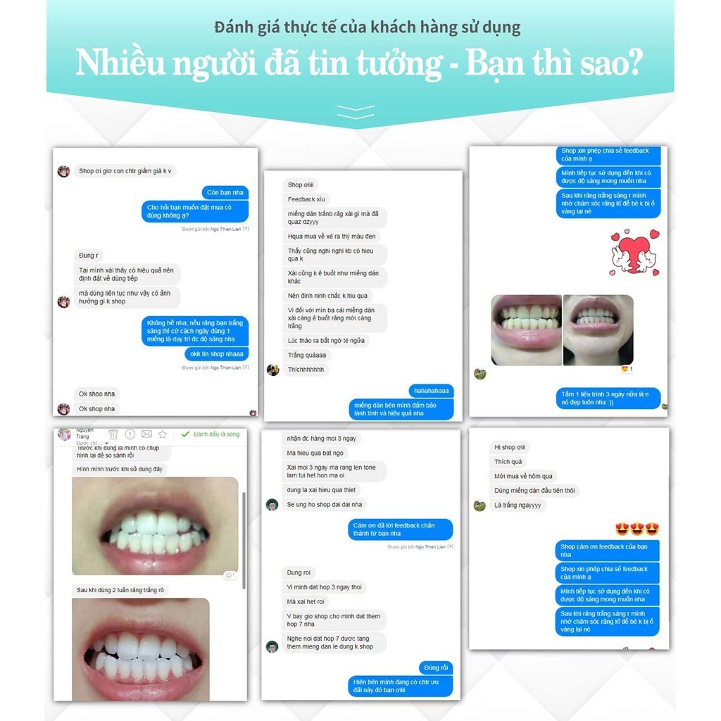 7 Gói - 14 Miếng Dán Trắng Răng SMILEKIT Teeth Whitening